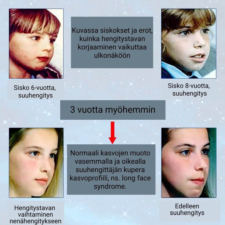 Suuhengityksen ja nenähengityksen vaikutukset ulkonäköön.